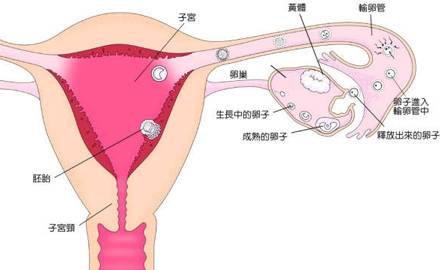 青春期多囊卵巢综合征