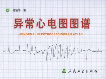 异常心电图图谱