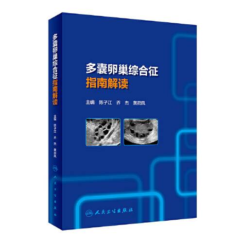 多囊卵巢综合征指南解读