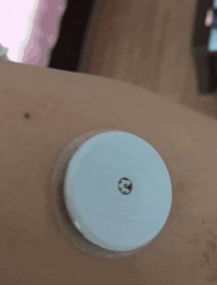 动态血糖检测系统