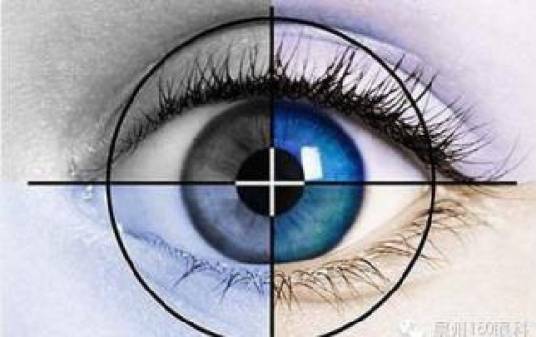 儿童青光眼(疾病症状)