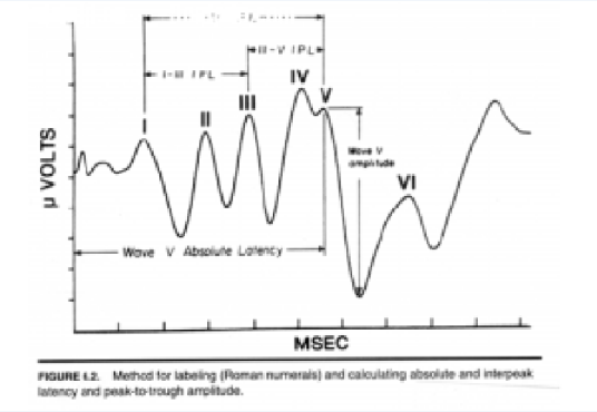 躯体感觉诱发电位