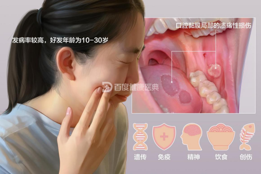 口腔溃疡(口腔疾病)