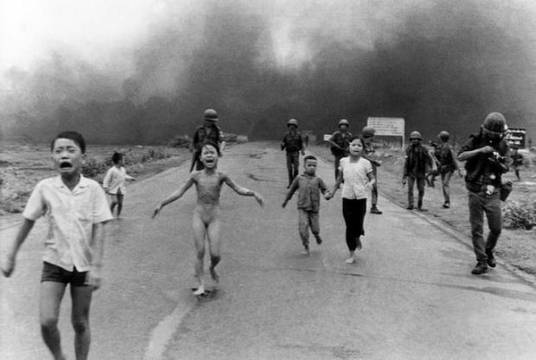 照片：被汽油弹烧伤的小女孩