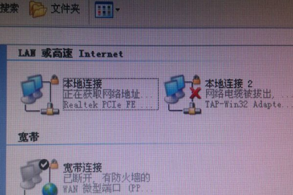 本地网络是什么意思
